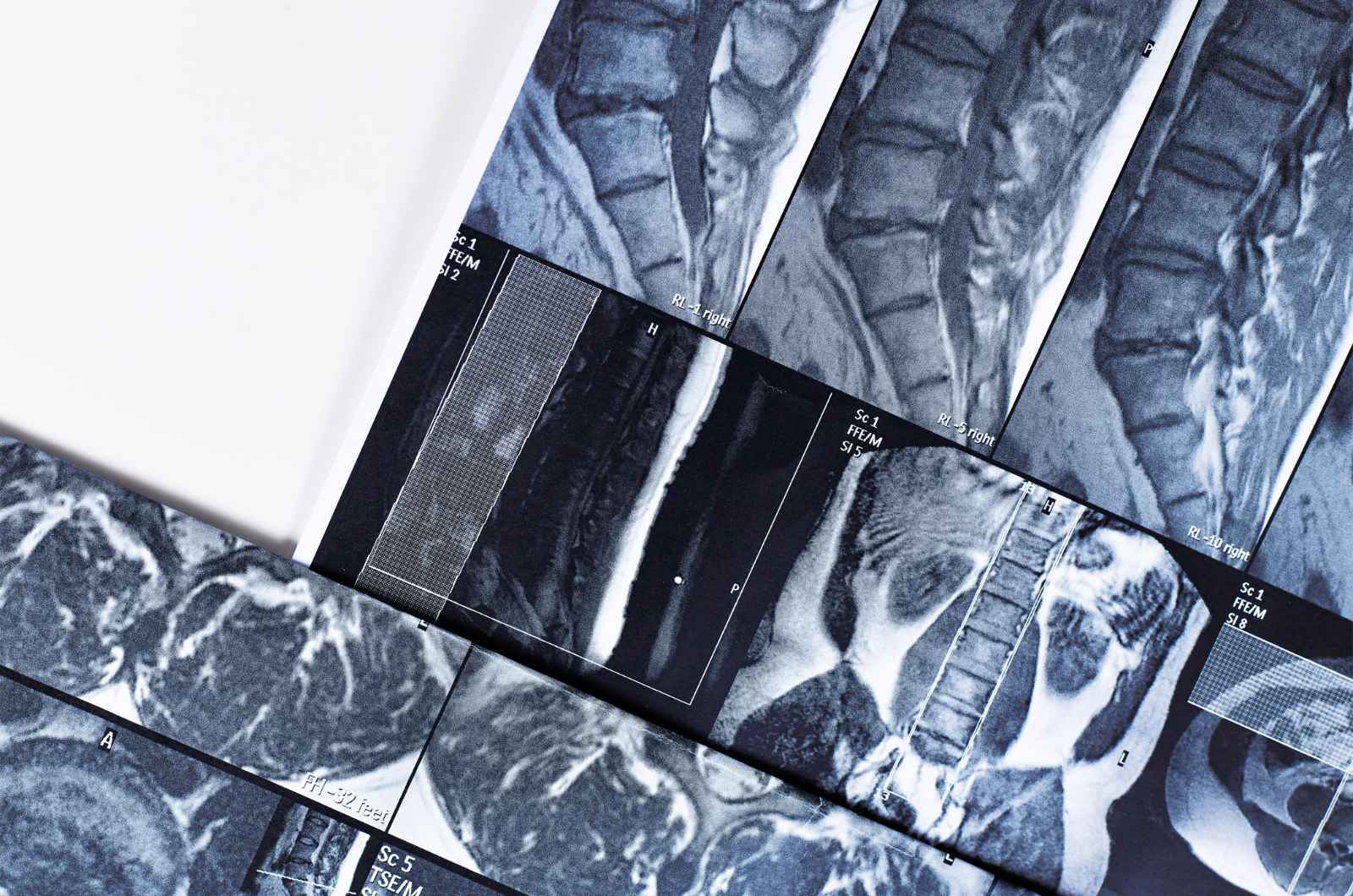 orthopedic medical device