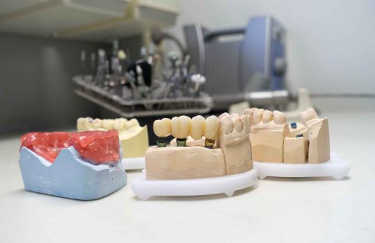 כתרים ללא מתכת זירקוניה – כל מה שאתה צריך לדעת2