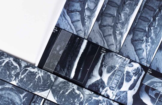 orthopedic medical device2